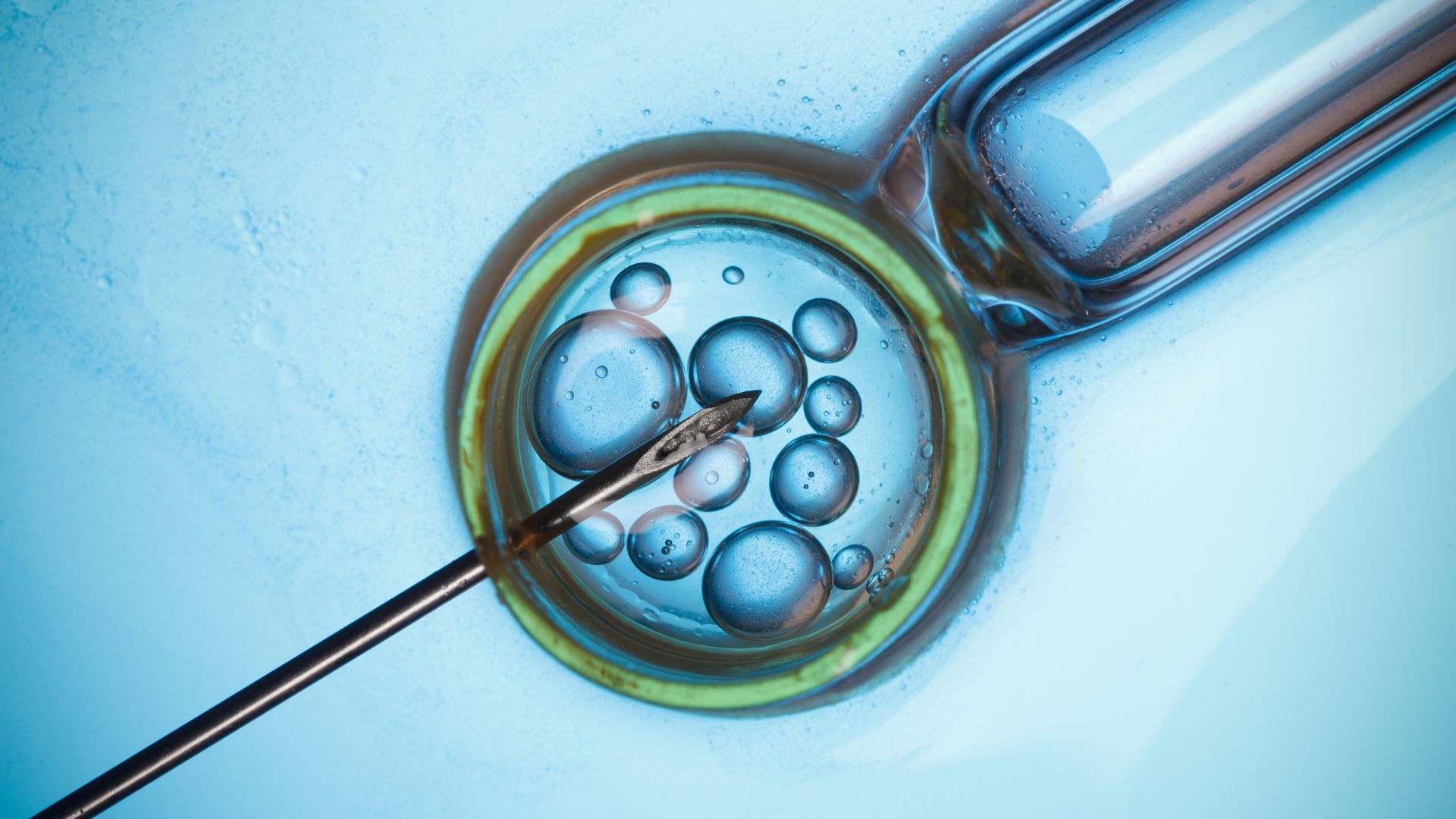 Understanding IVF