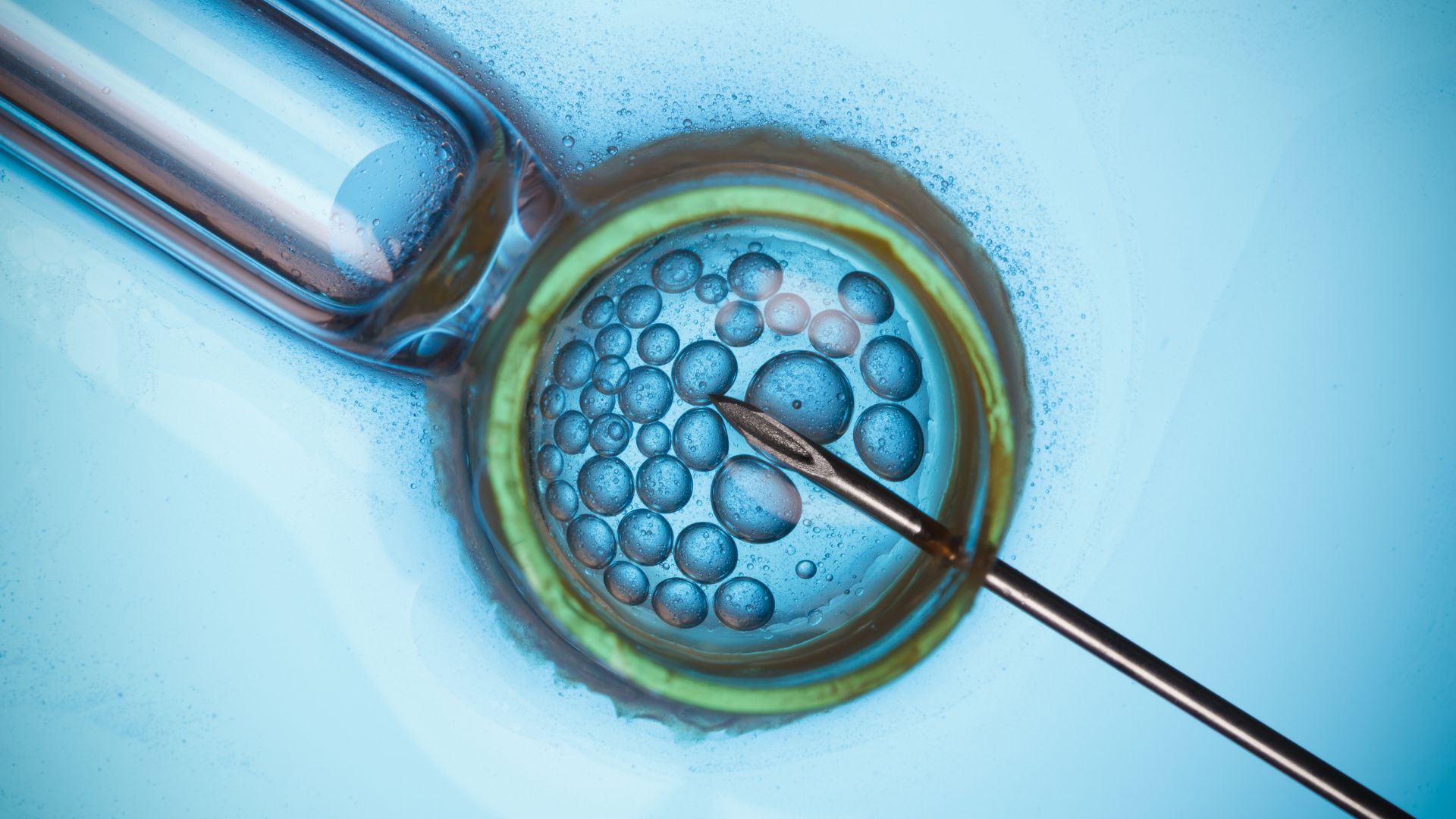 Boosting Your IVF Success