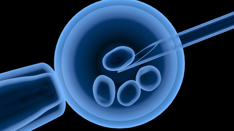 IVF Explained