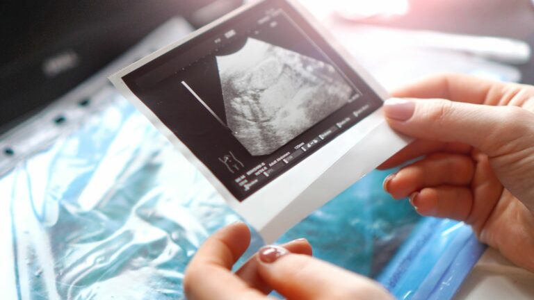 PGS for Healthy Pregnancies: Understanding the Process, Pros, and Cons