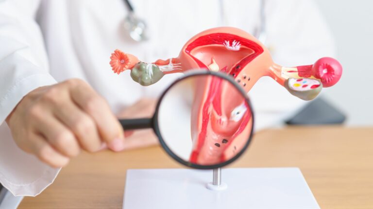 IVF and Severe Endometriosis