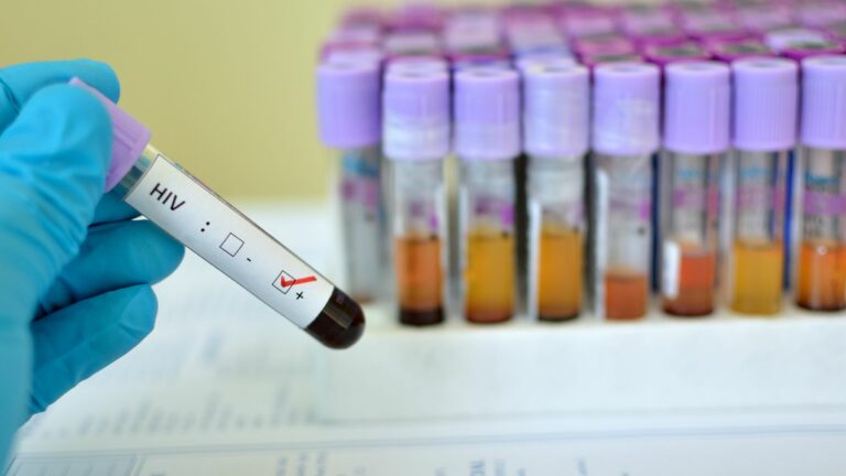 IVF for HIV-Positive Patients in India