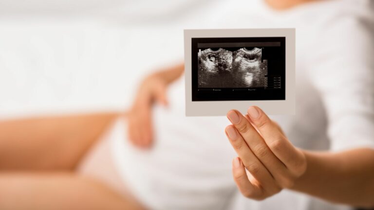 Ovarian Cysts and IVF in India
