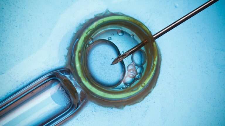 TESE and IVF/ICSI in India: A Comprehensive Guide for Couples